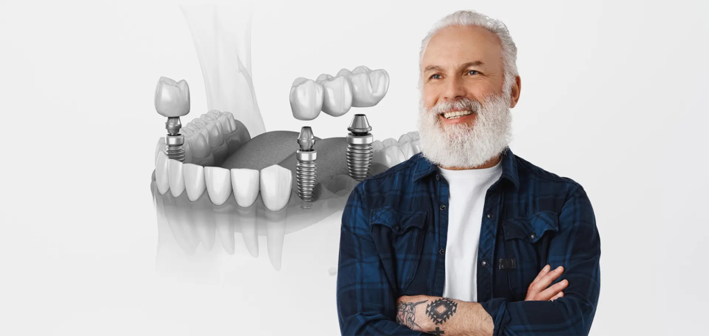 Uśmiechnięty starszy mężczyzna z siwą brodą stoi na tle ilustracji przedstawiającej rozwiązanie braków zębowych za pomocą mostu protetycznego opartego na implantach.
