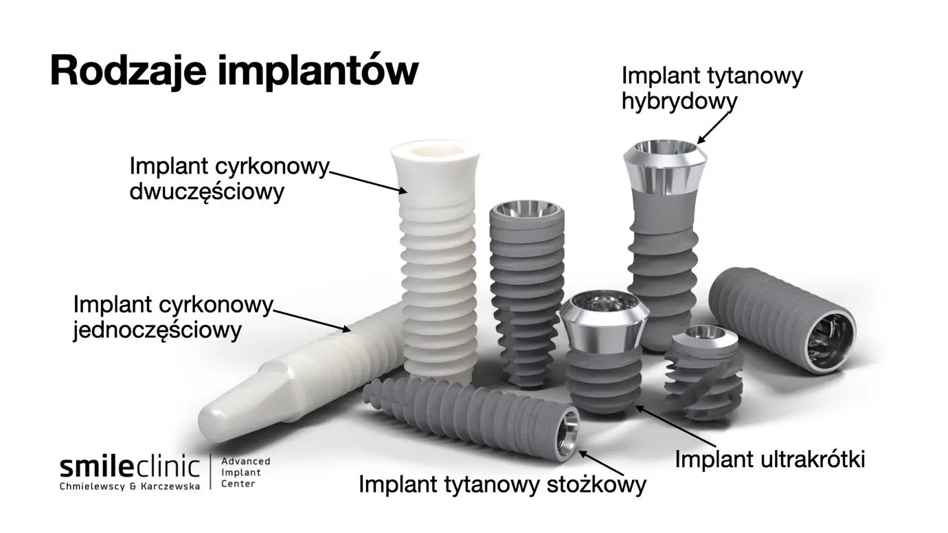 image2 Wizualizacja różnych typów implantów zębowych: cyrkonowych jedno- i dwuczęściowych, tytanowych stożkowych, ultrakrótkich i hybrydowych